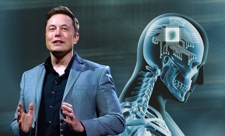 Elon Musk anunció que NeuraLink implantó el primer chip en un cerebro humano